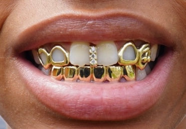 What To Expect With A Custom Grill